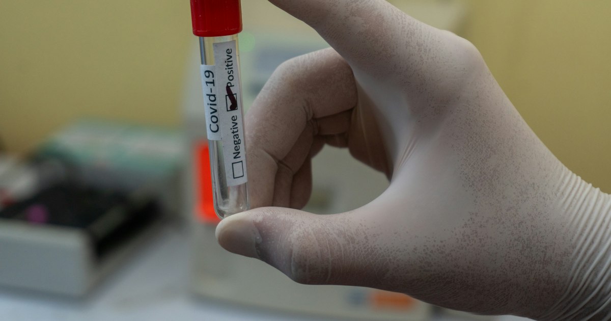 How to prepare for the Glycated Hemoglobin (HbA1c) test: rules for taking it